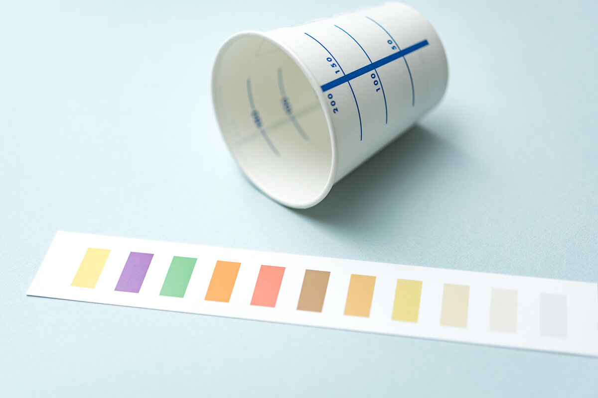 犬の尿石症の主な原因6つ